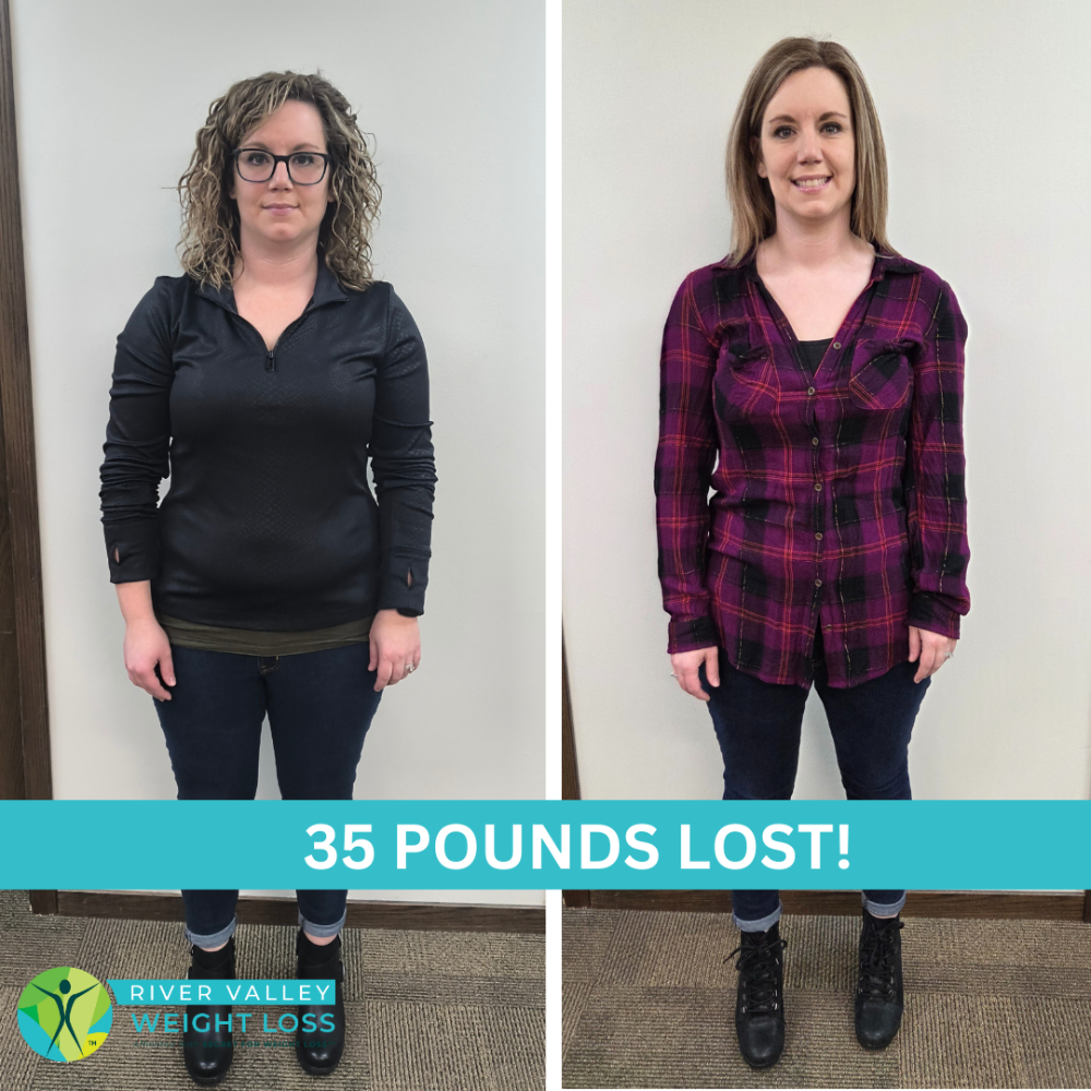 Before and after weight loss transformation of a woman, with text '35 Pounds Lost!' and 'River Valley Weight Loss' logo.